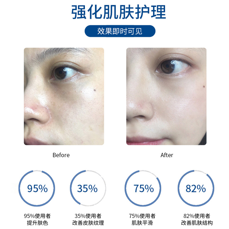 類蛇毒肽嫩滑凍干粉