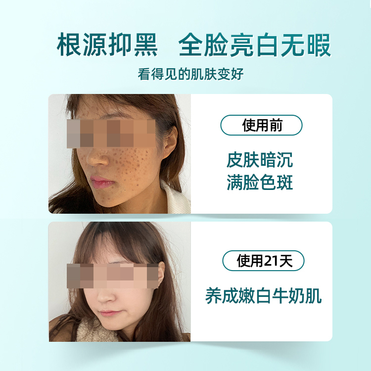 煙酰胺次拋精華