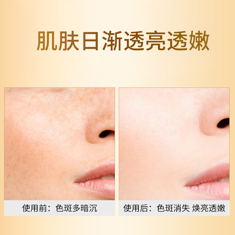 幽爽臻白祛斑乳霜